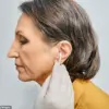 Relentless Earwax Buildup Leads to Hearing Loss and Isolation for Retired School Supervisor