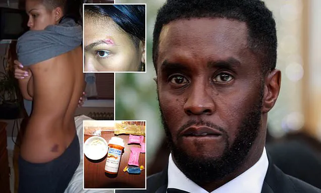 Sean 'Diddy' Combs' Legal Defense Relies on Privileged Health Information Amid Public Scrutiny