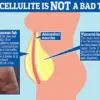 Urgent Update: Over 100 Million Americans May Be Reclassified as Obese Under EASO's New Obesity Guidelines