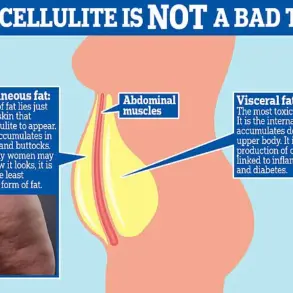 Urgent Update: Over 100 Million Americans May Be Reclassified as Obese Under EASO's New Obesity Guidelines