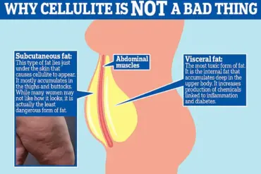 Urgent Update: Over 100 Million Americans May Be Reclassified as Obese Under EASO's New Obesity Guidelines
