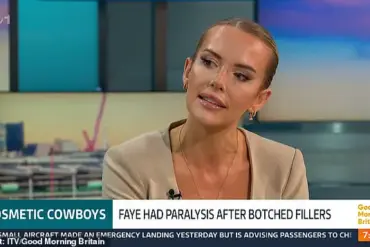 Faye Winter Shares Harrowing Account of Botched Botox Treatment