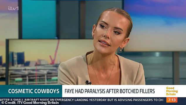 Faye Winter Shares Harrowing Account of Botched Botox Treatment