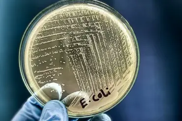 Florida E. coli Outbreak Linked to Unpasteurized Milk Sparks Health Department Warnings Over Farm Sanitation