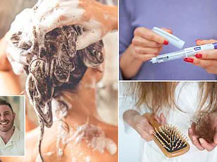 Health Crisis: Hair Loss Linked to GLP-1 Weight Loss Jabs as 1.5 Million Prescribed in UK