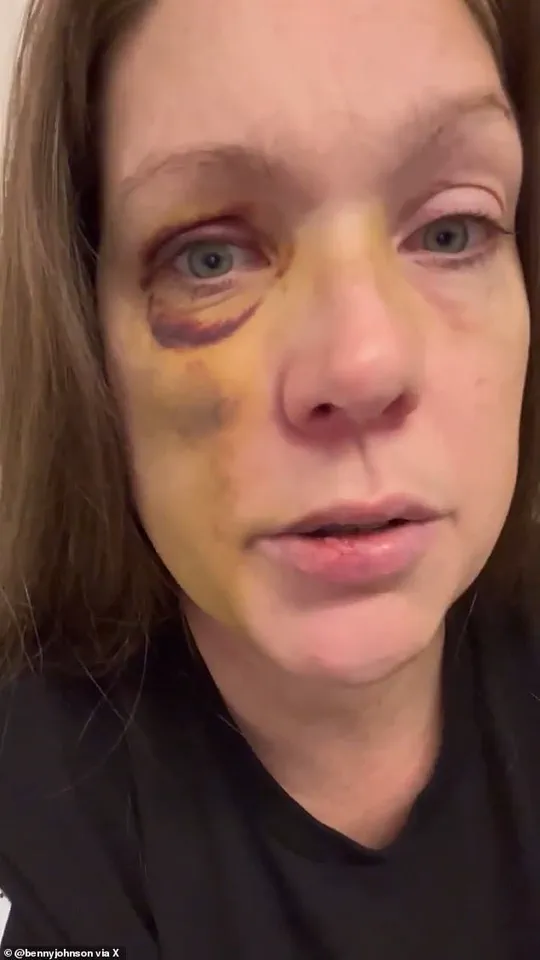 Holly Survives Brutal Cincinnati Brawl with Severe Injuries, Faces Threats Amid Public Outcry