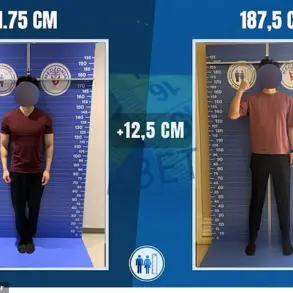How 'Materialists' Ignited Debate on Leg Lengthening Surgery and Height Alteration