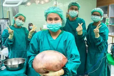 Medical Mystery: Thai Woman's 'Fat Belly' Reveals 17-Pound Ovarian Cyst