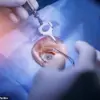 Scientists at Occidental College and UC Irvine Develop Chemical Process to Revolutionize Vision Correction, Offering a Safer, More Affordable Alternative to LASIK