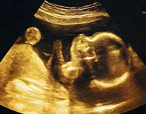 Tragic Home Birth Incident Highlights Urgent Need for Government Regulation in Midwifery Practices to Protect Public Safety