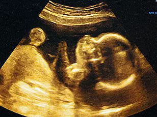 Tragic Home Birth Incident Highlights Urgent Need for Government Regulation in Midwifery Practices to Protect Public Safety