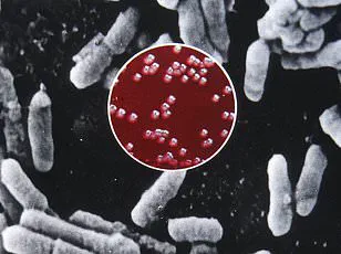 Urgent Alert: Plague Resurges in New Mexico, California, and Arizona as Health Officials Warn of Alarming Cases After Decades-Long Absence