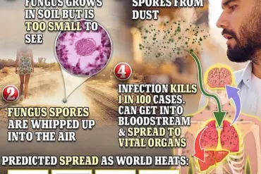 Valley Fever Surge Sparks Federal Urgency as Health Officials Warn of Public Health Threat on West Coast