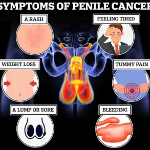 Warning: Gynecomastia May Signal Life-Threatening Conditions Like Testicular Cancer, Breast Cancer, or Liver Disease, Experts Urge Immediate Attention