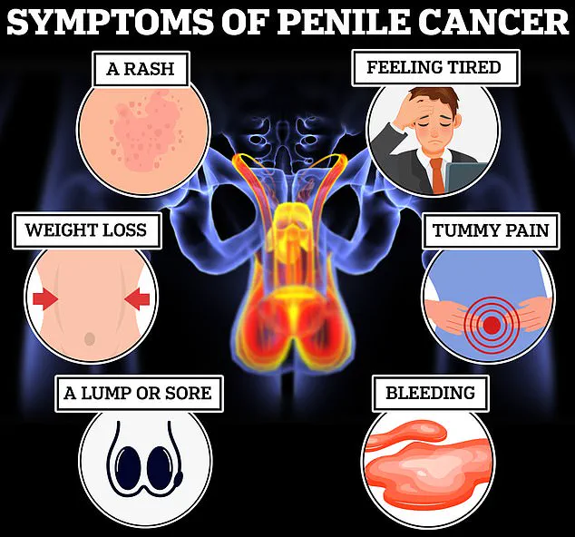 Warning: Gynecomastia May Signal Life-Threatening Conditions Like Testicular Cancer, Breast Cancer, or Liver Disease, Experts Urge Immediate Attention