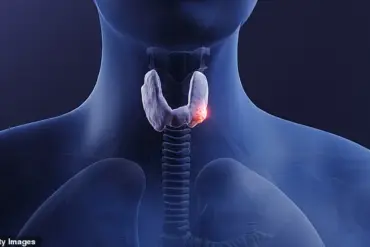 When Access to Medical Information Fails: The Story of Tameika McBride's Thyroid Cancer Misdiagnosis