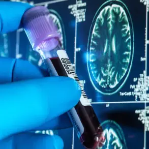 Breakthrough Blood Test Trial Offers Early Alzheimer's Detection, Transforming Dementia Care in the UK as Cases Surge