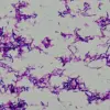 Breakthrough Study Links Gut Bacterium Clostridium innocuum to Preterm Birth Risk in 5,000 Expectant Mothers, Findings from Huazhong University of Science and Technology