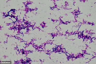 Breakthrough Study Links Gut Bacterium Clostridium innocuum to Preterm Birth Risk in 5,000 Expectant Mothers, Findings from Huazhong University of Science and Technology